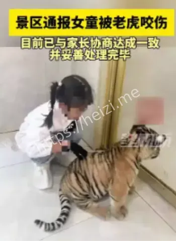 女童被老虎咬伤